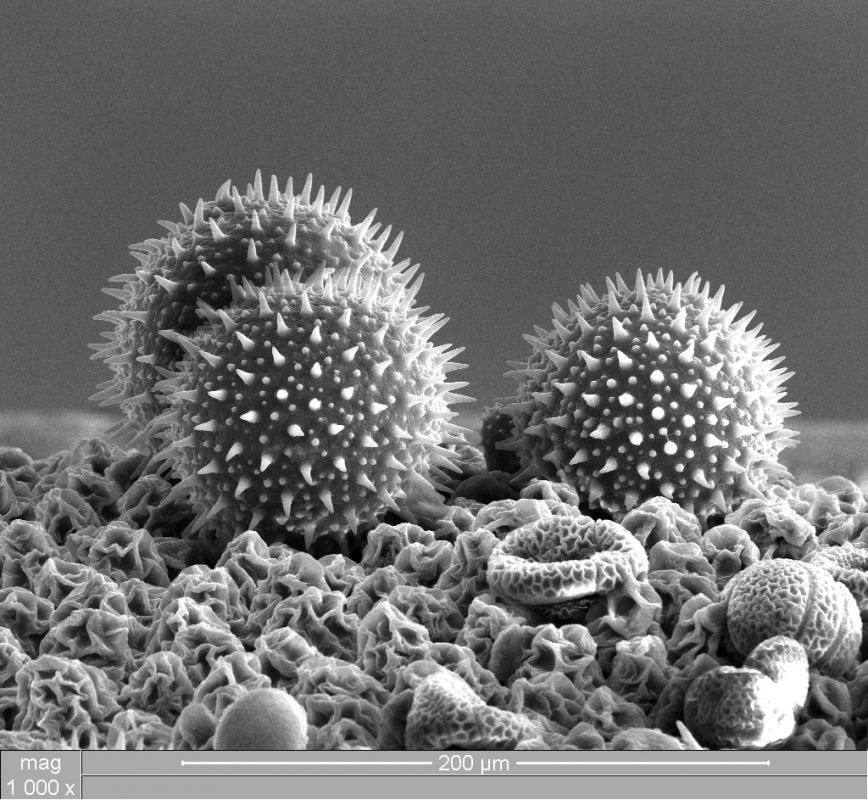 Frans Holthuysen, foto van berkenpollen, vooraan rechts twee kleine passiebloem pollen. gemaakt met een electronenmikroscoop, MiPlaza Philips Eindhoven.
PHŒBUS•Rotterdam